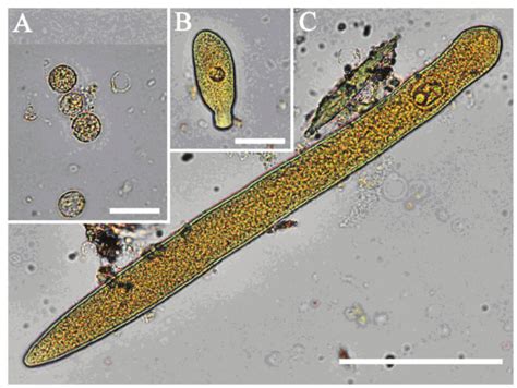  Gregarine! A Microscopic Marvel That Lives Within Other Creatures