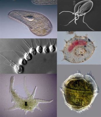 Klossiella!  These Parasitic Protozoa Are Truly Masters of the Microscopic World