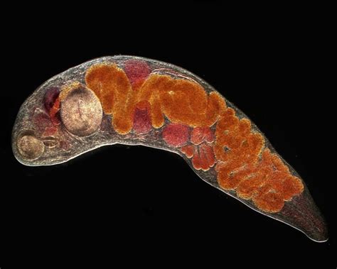 Jacksoni Trematode: A Tiny Worm That Thrives in the Unexpected!