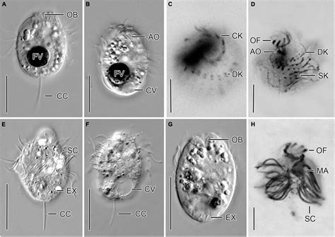  Urotricha! A Ciliate With Tentacles That Defy All Expectations 